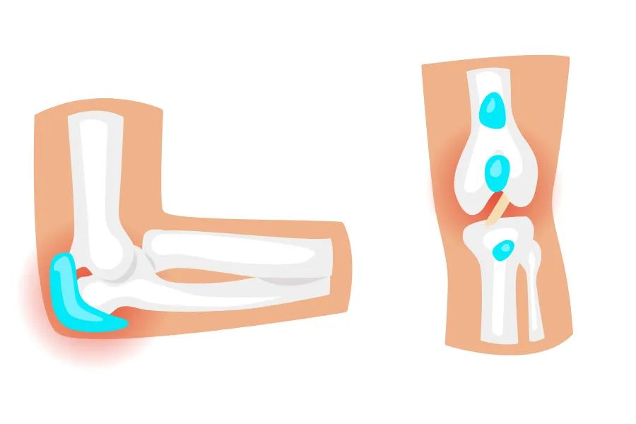 The Anatomy of a Bursa_ Your Joint’s Shock Absorber