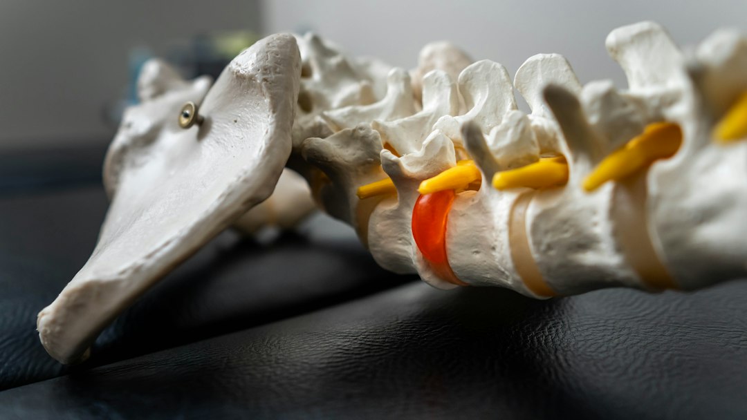 ankylosing spondylitis spine pain